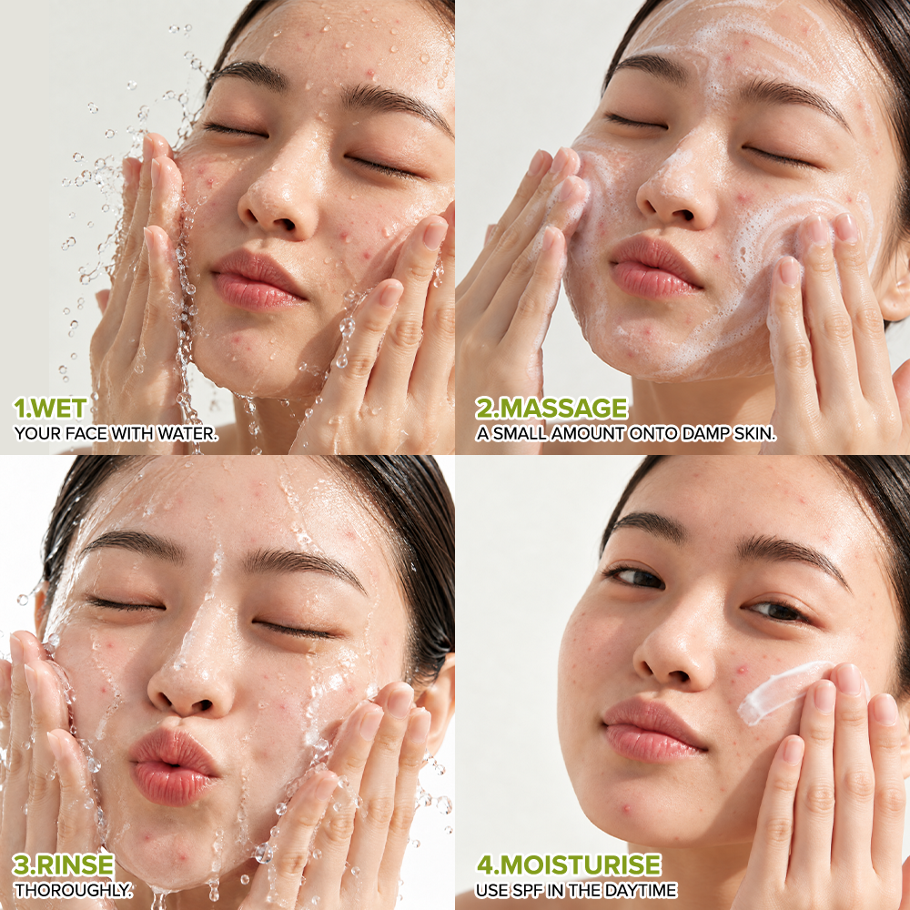Acne Care Anti Acne Gel Face Wash 100ml