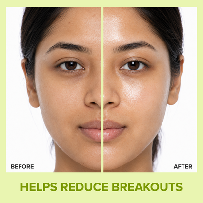 Acne Care Hydrating Moisturiser